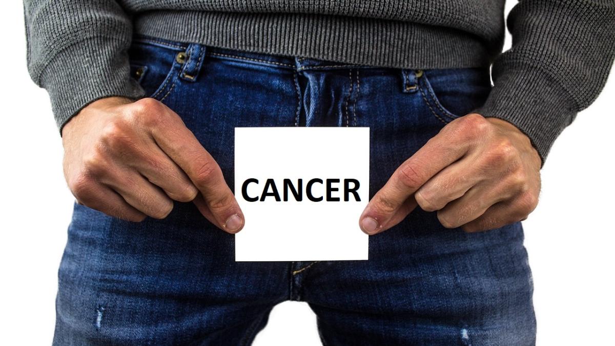 cancer_67330700