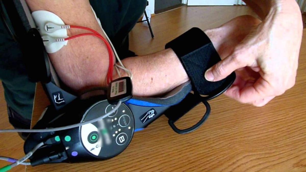 brat_robotic_avc_stroke_sursa_youtube_30809100