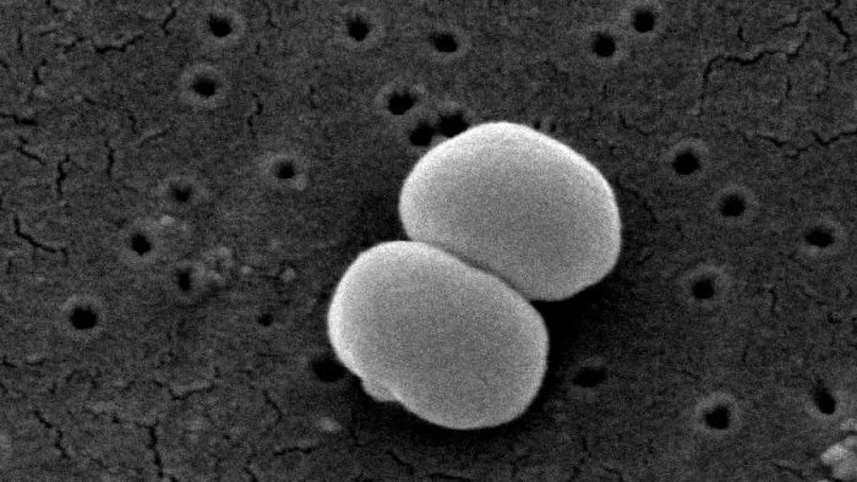 bacterie_staphylococcus_epidermidis_71549200