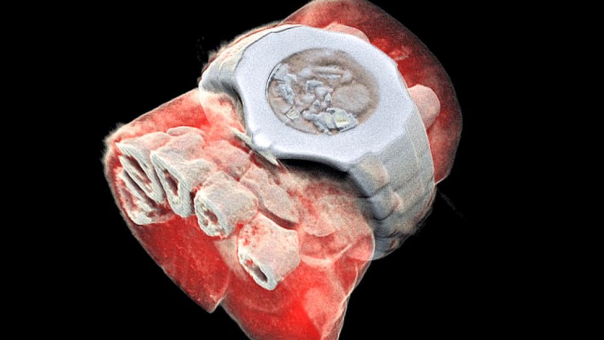 scan_3d_color_mana_incheietura_foto_mars_bioimaging_ltd_80557500
