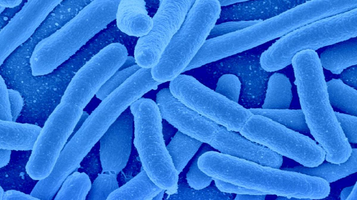 bacterie_tuberculoza_1_76073400
