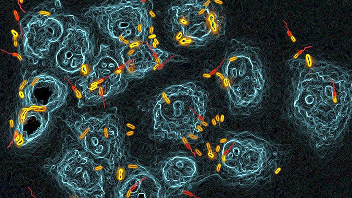 celule_pulmonare_atacate_de_psudomonas_foto_credit_biozentrum_university_of_basel_31797100