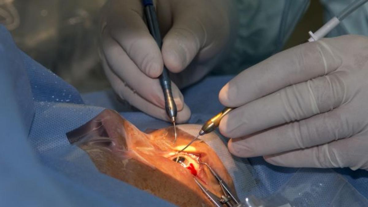transplant_cornee_spitalul_militar_45702100