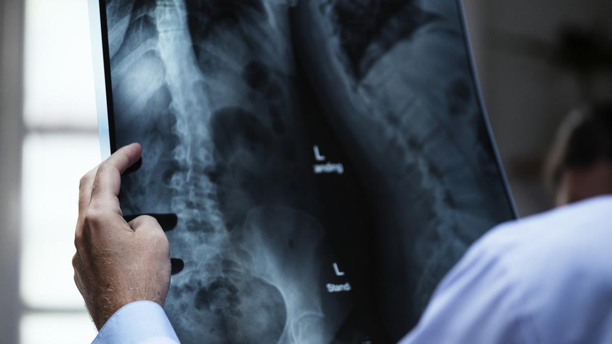 oase_schelet_radiografie_44747700