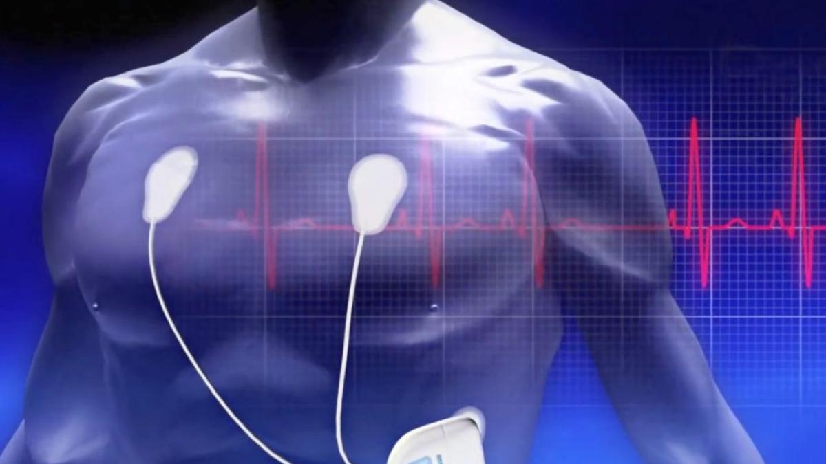 holter_monitor_foto_zensor__intelesens_09755500