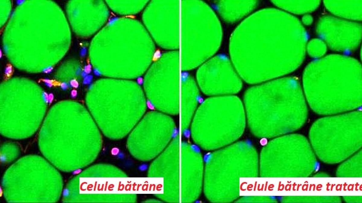 celule_batrane_tratate_lamivudina_foto_brown_university_65522300