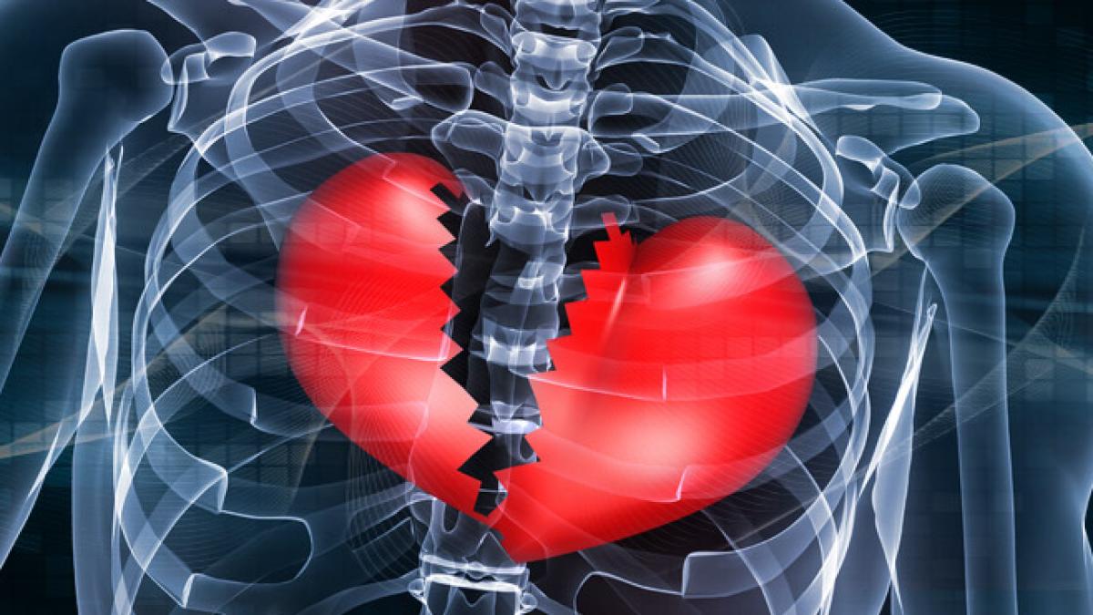 infarct_02604600