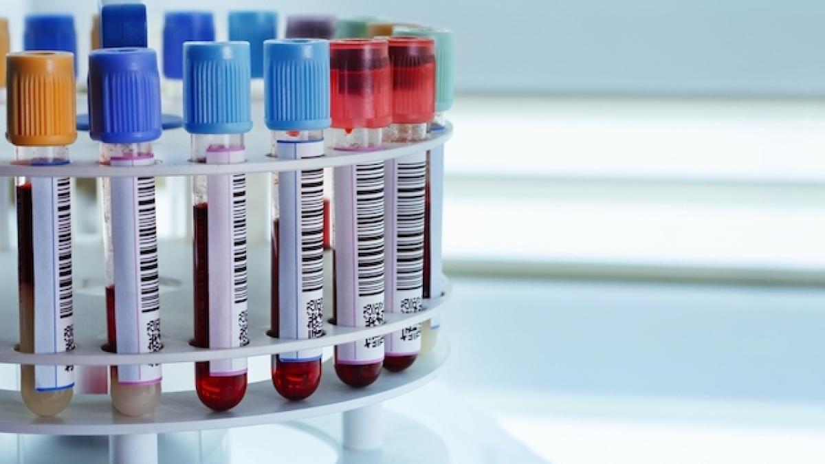 anemia_68492500