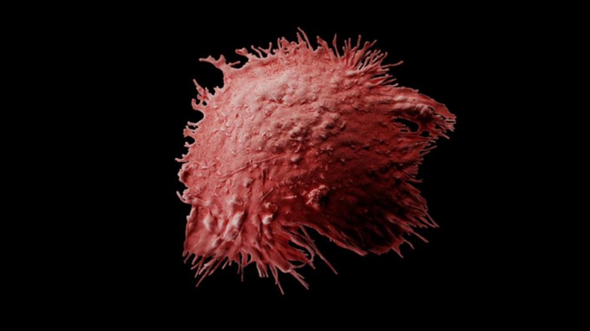 celula_dendritica_foto_lund_university_94884500