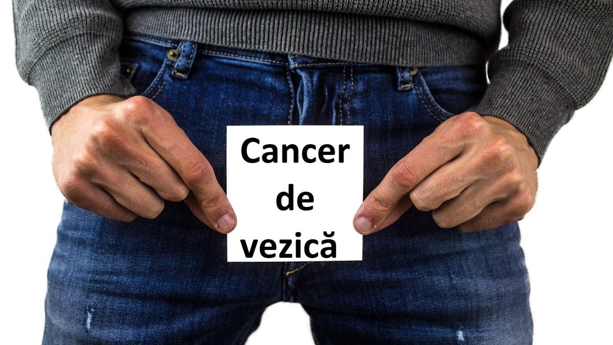 cancer_vezica_37804300