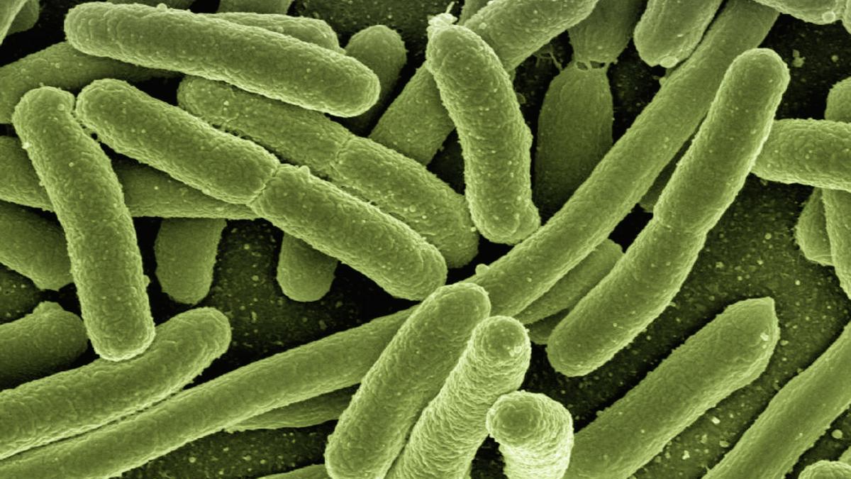 e_coli_bacterie_bacteria_bacterii_91422200