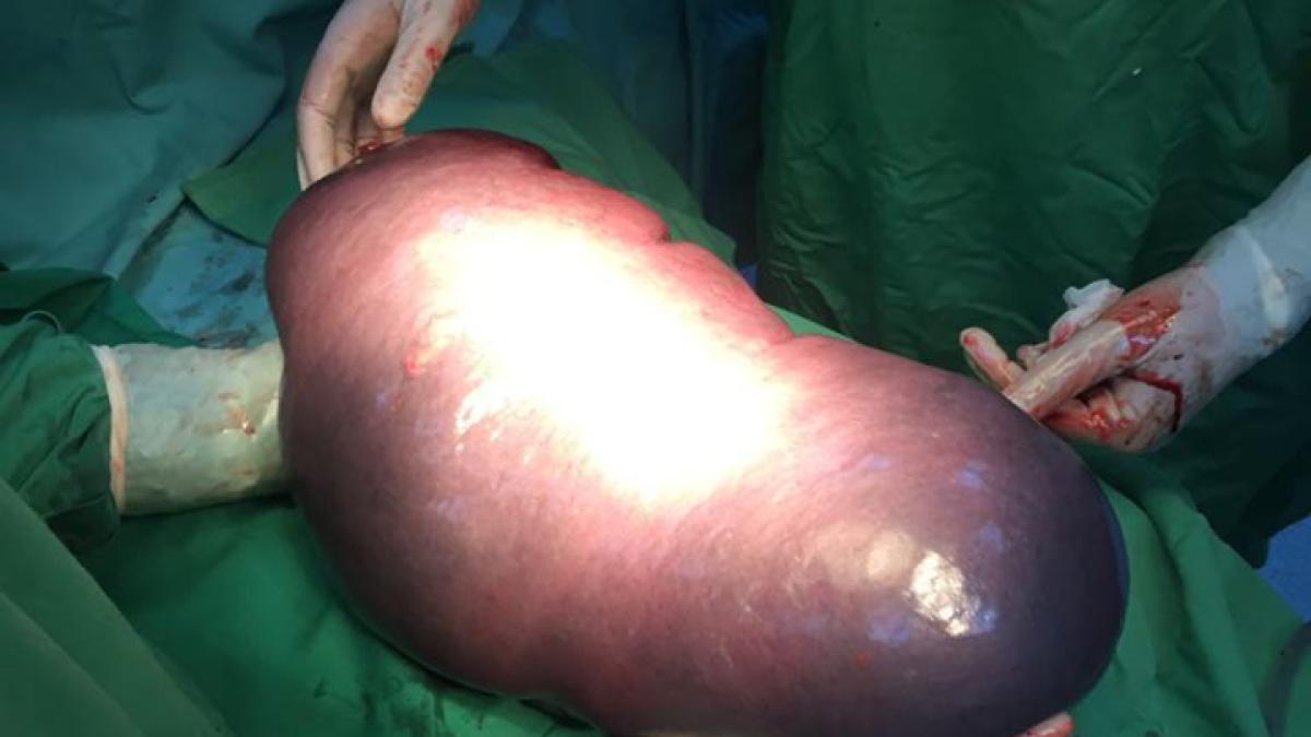 splina_gigant_36932900