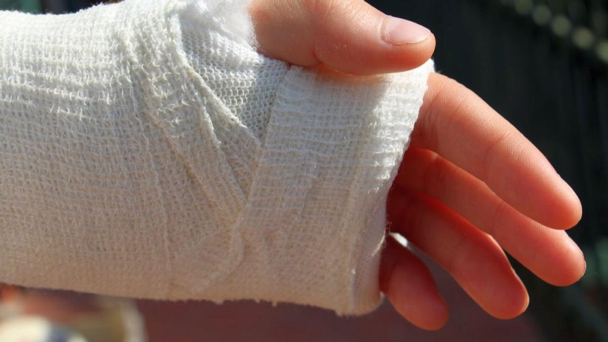 durere_mana_atela_gips_03776000