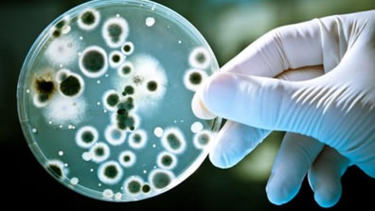 candida_auris_44983100