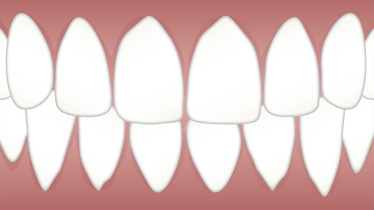 dental_3599752_1280_43116200