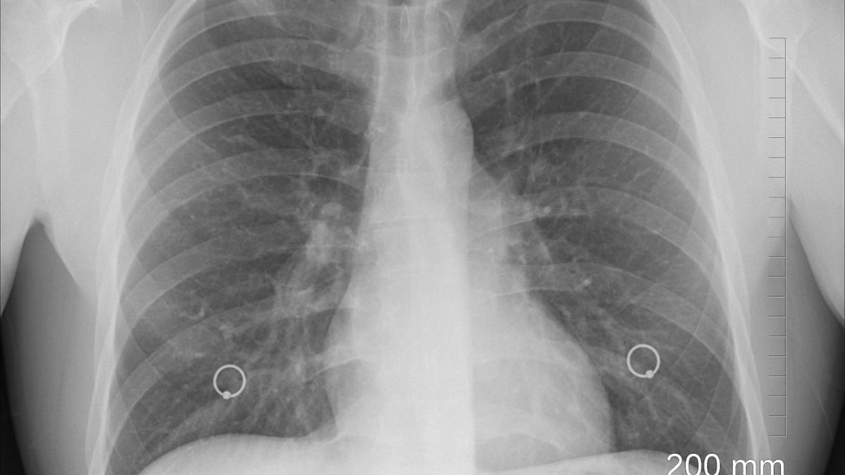 xray_1476620_1280_20383900