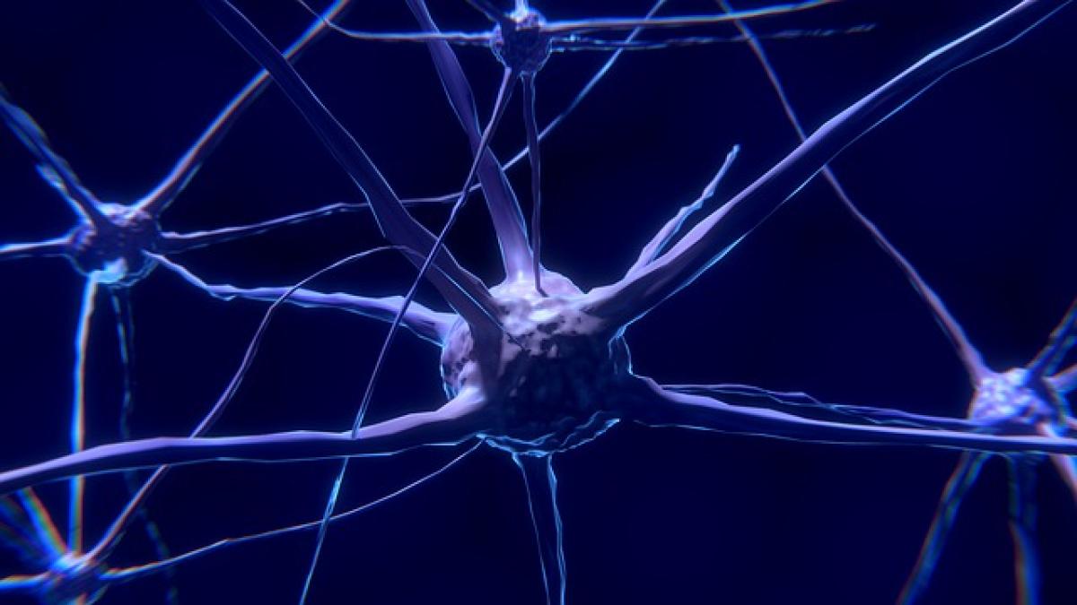 neuron_boala_alzheimer_86413700