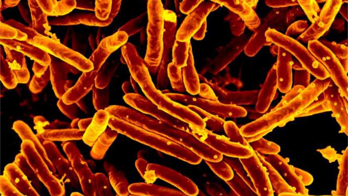 tuberculoza_niaid_usa_73958100