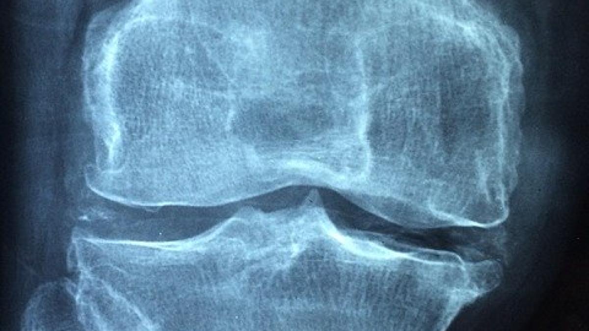 knee_1406964_640_38259700