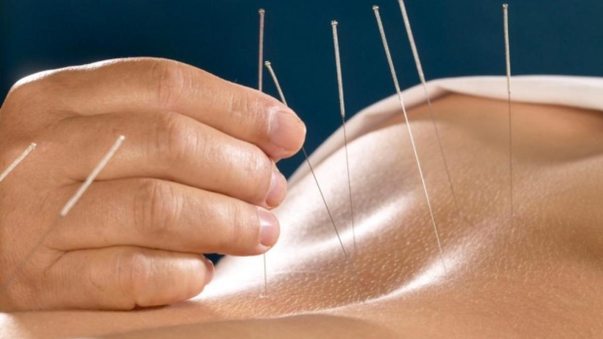 acupunctura_tine_departe_medicamentele_552444_63439600