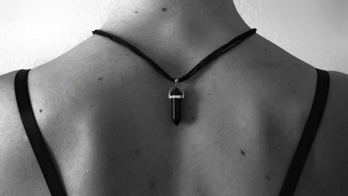 alunite_nevi_piele_spate_70075800