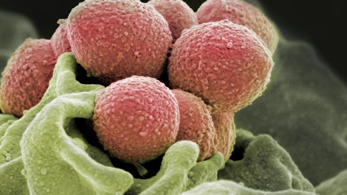 streptococcu_78229900