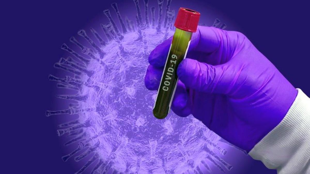 covid_19_test_analiza_eprubeta_coronavirus_16601600