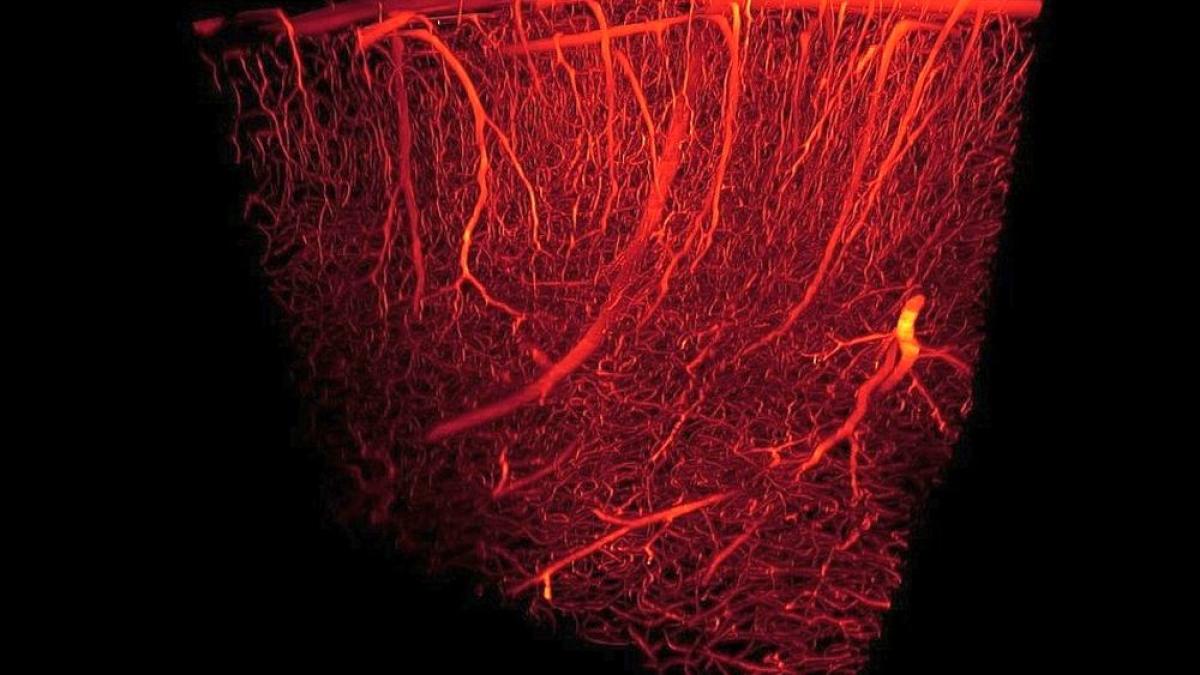 blood_vessels_rendering_photo_ucl_08231800