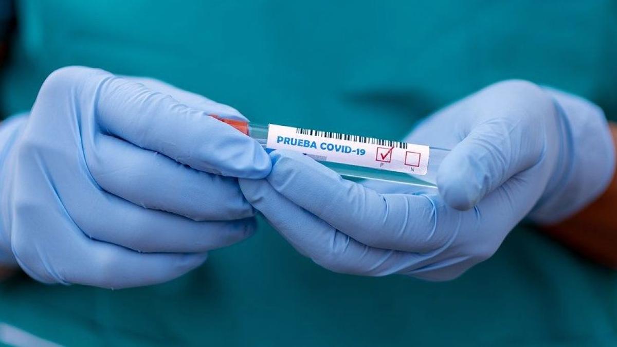 covid_19_test_pozitiv_coronavirus_eprubeta_analiza_64092400