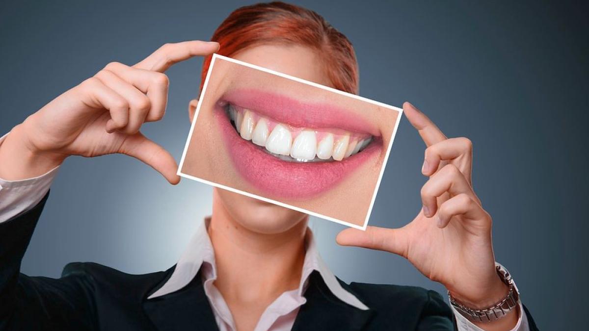 dinti_albi_detartraj_stomatologie_dentist_07587700
