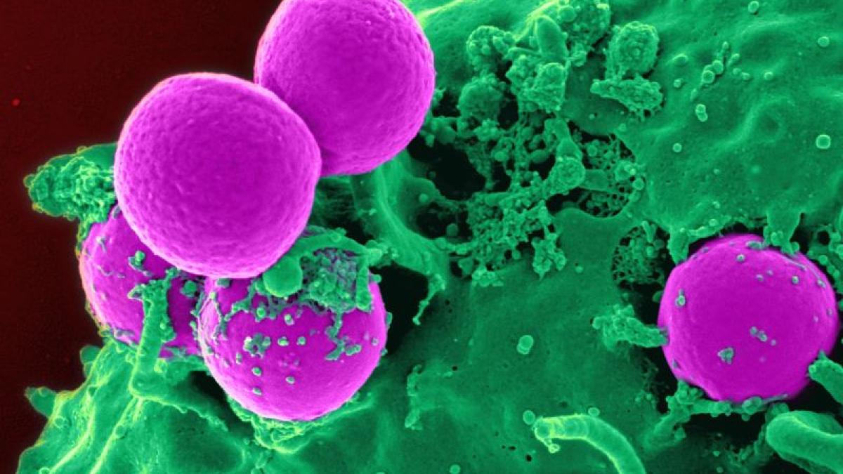 celule_cancer_particule_57308900
