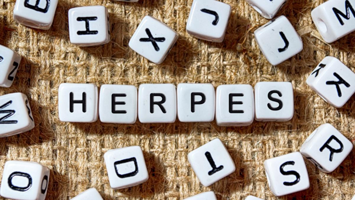herpes_foto_farmacia_ta_82605900