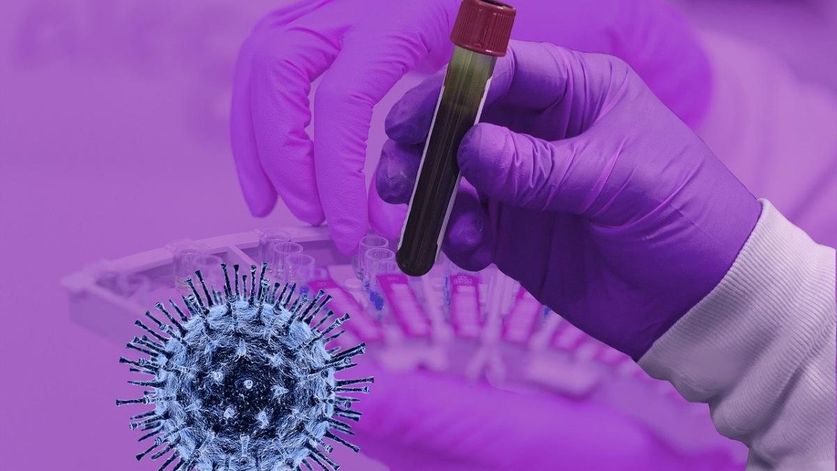 nipah-virus_17971100