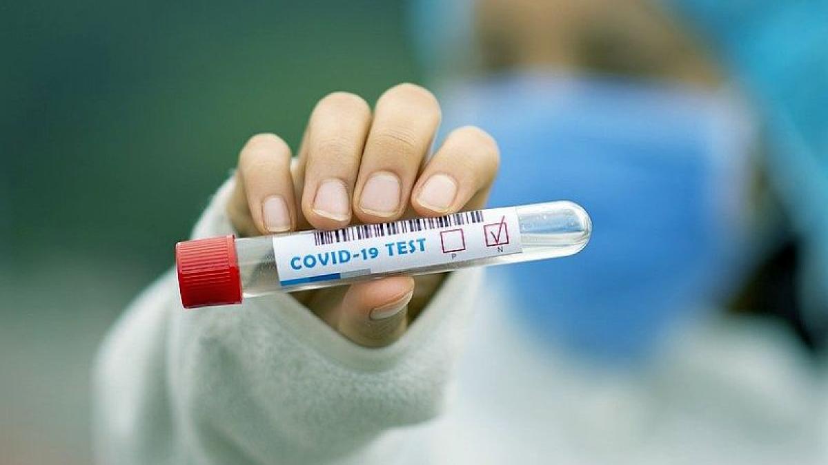 test_covid_coronavirus_negativ_analiza_eprubeta_11697100