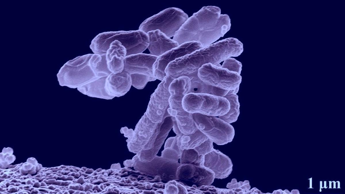 bacterie_tuberculoza_89201900