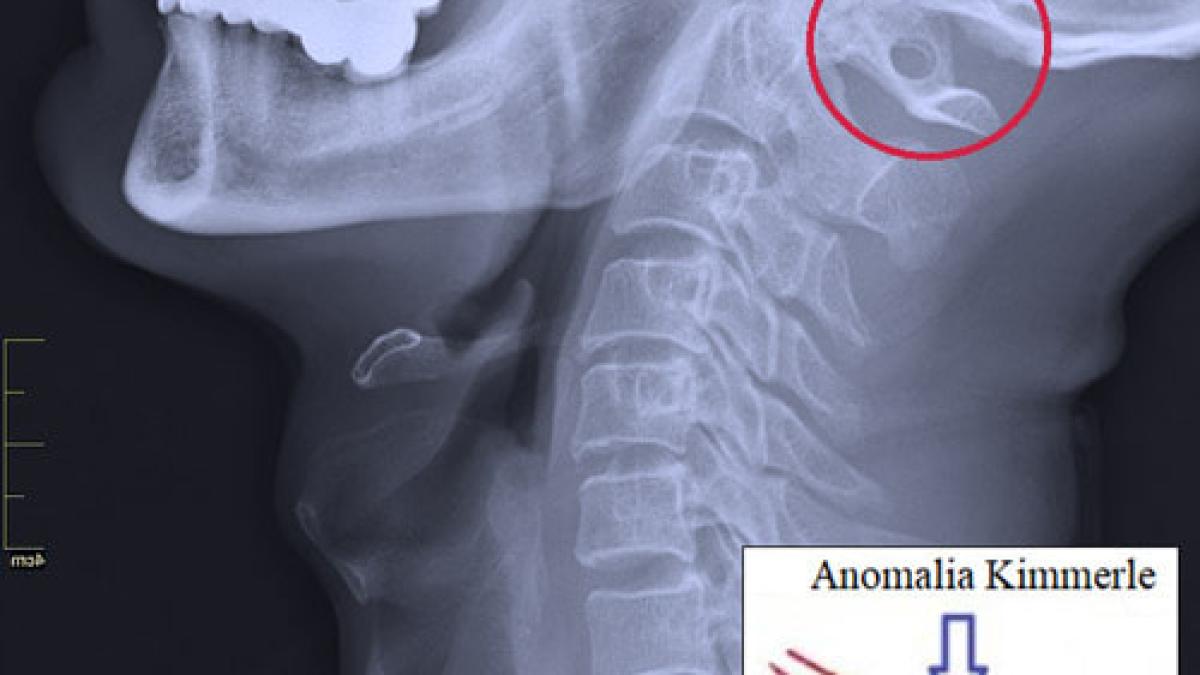anomalia-kimerle_70481100