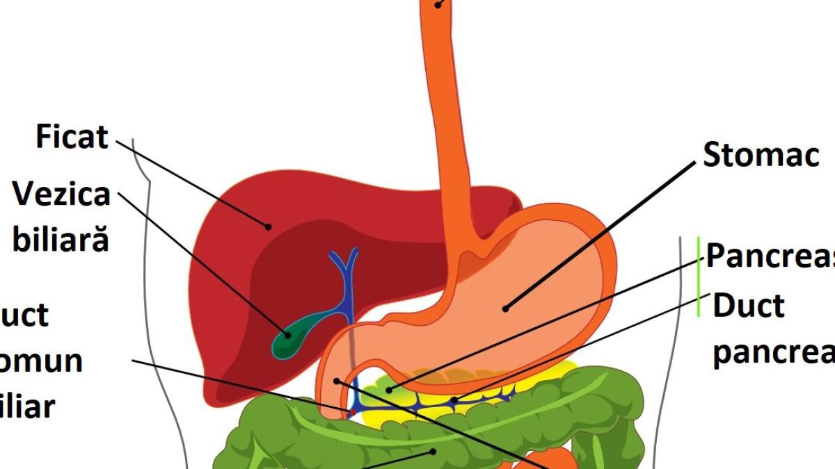 calculi_bila_duct_97399100