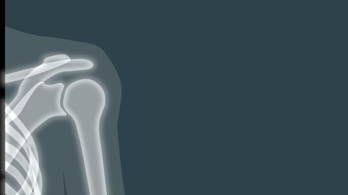umar-radiografie-foto-pixabay_24483200