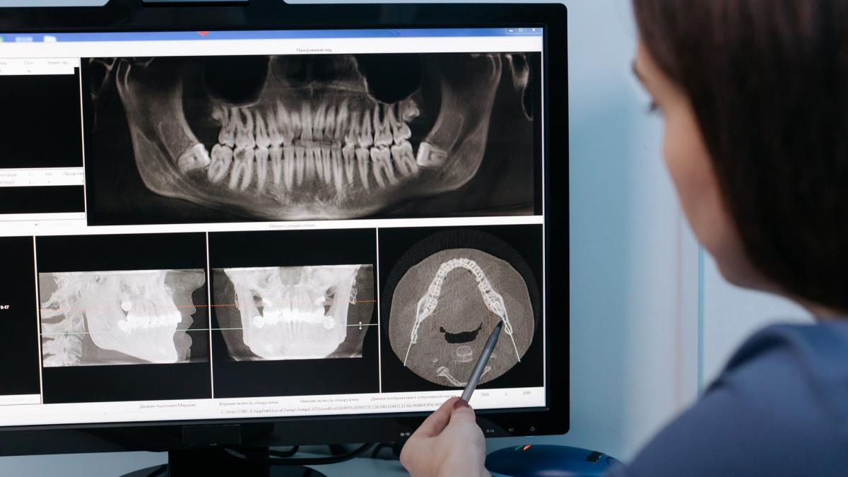 carii-dentare_61168600