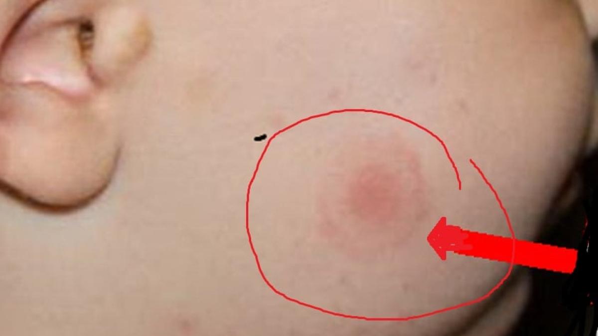 muscatura-capusa_27557800