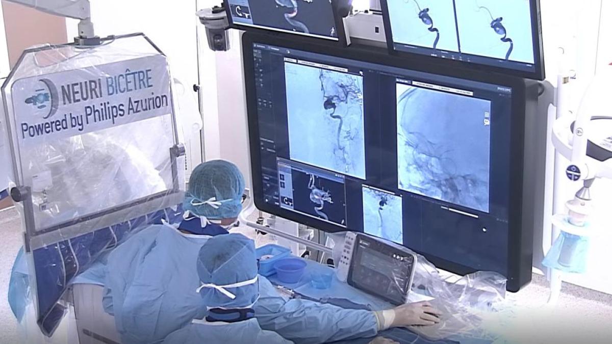 neuroradiologie-interventionala-1_81620500