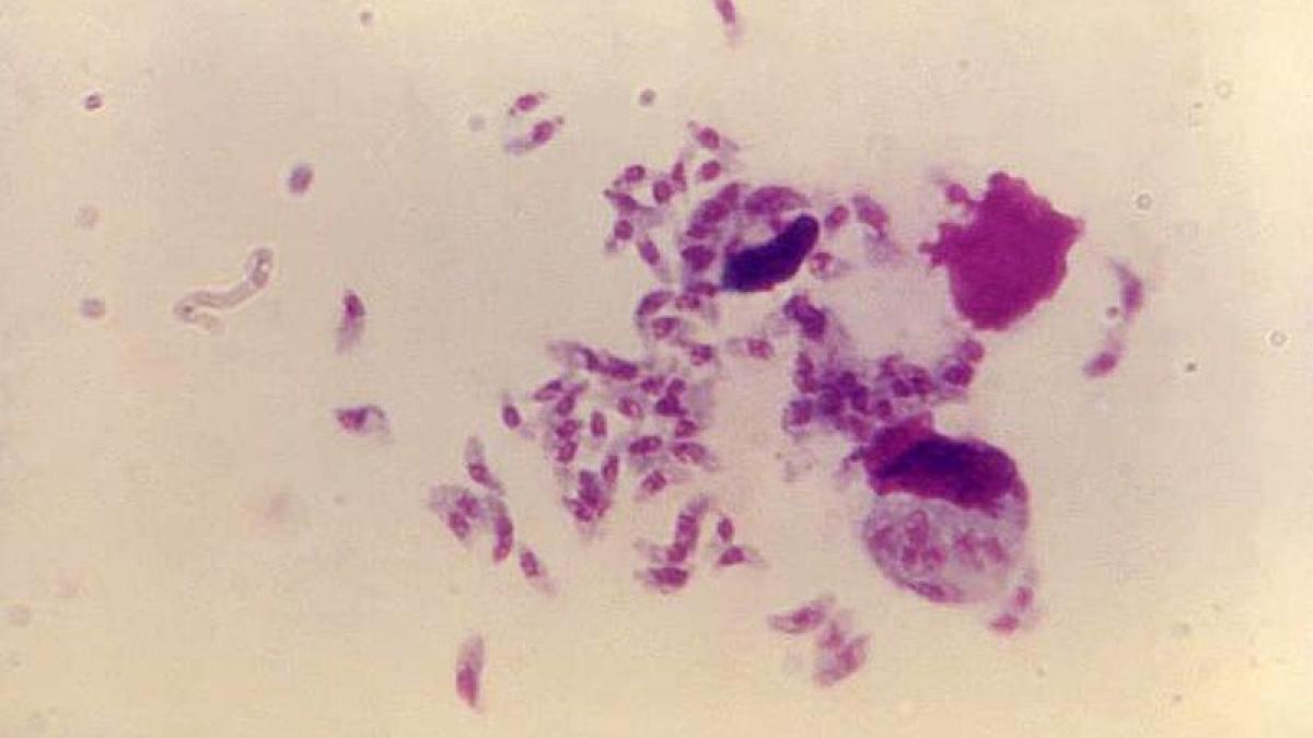 toxoplasma-gondii-cdc_35182800