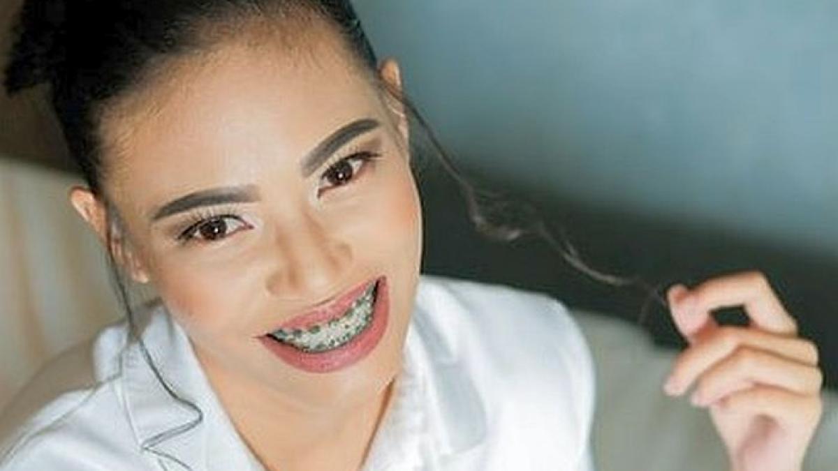 aparat-dentar_52644000