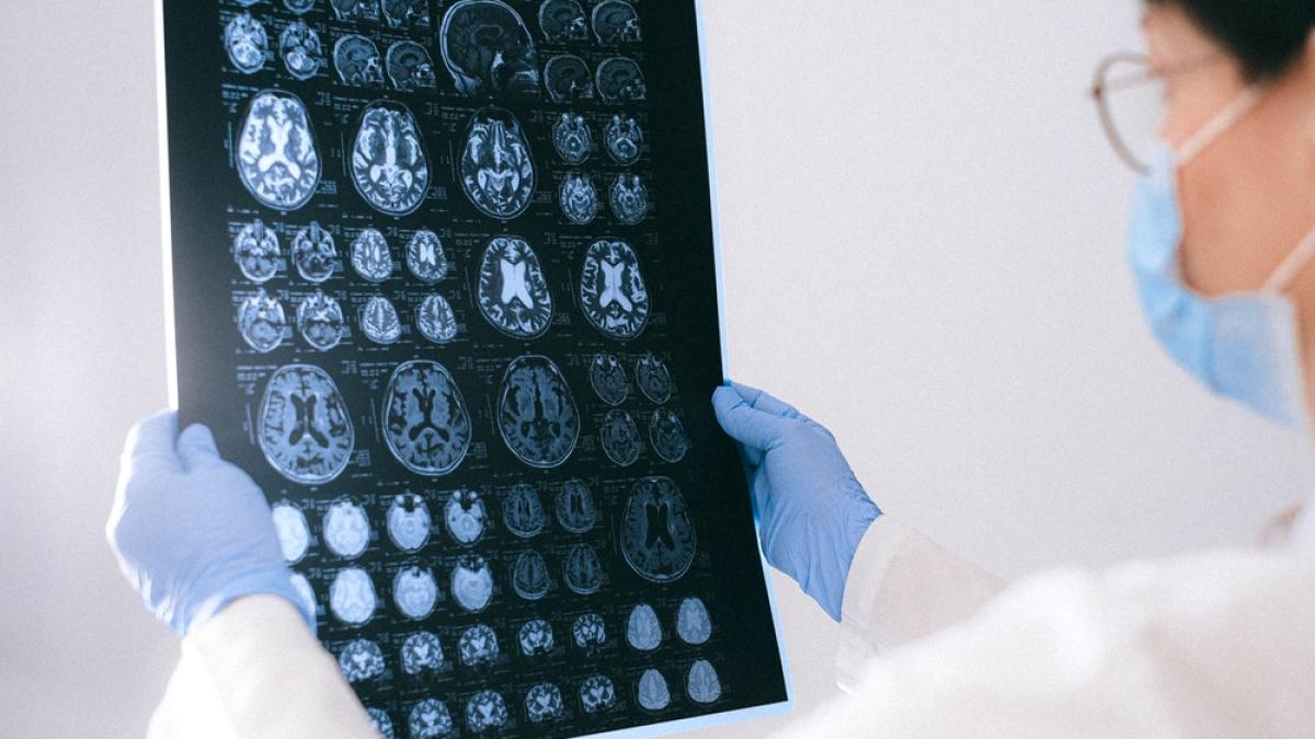 rmn-radiografii-creier-pexels-anna-shvets-4226219_09631900