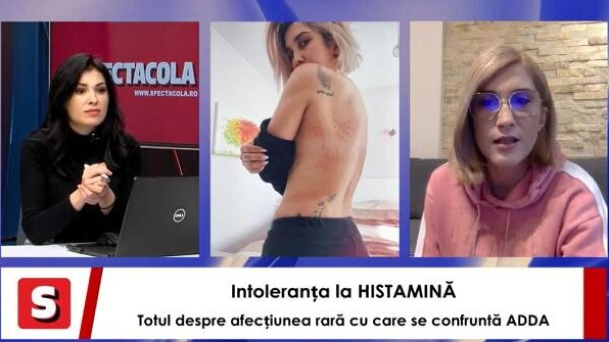 adda-rares-simu-georgiana-ionita-intoleranta-histamina-2_80298700_18102900