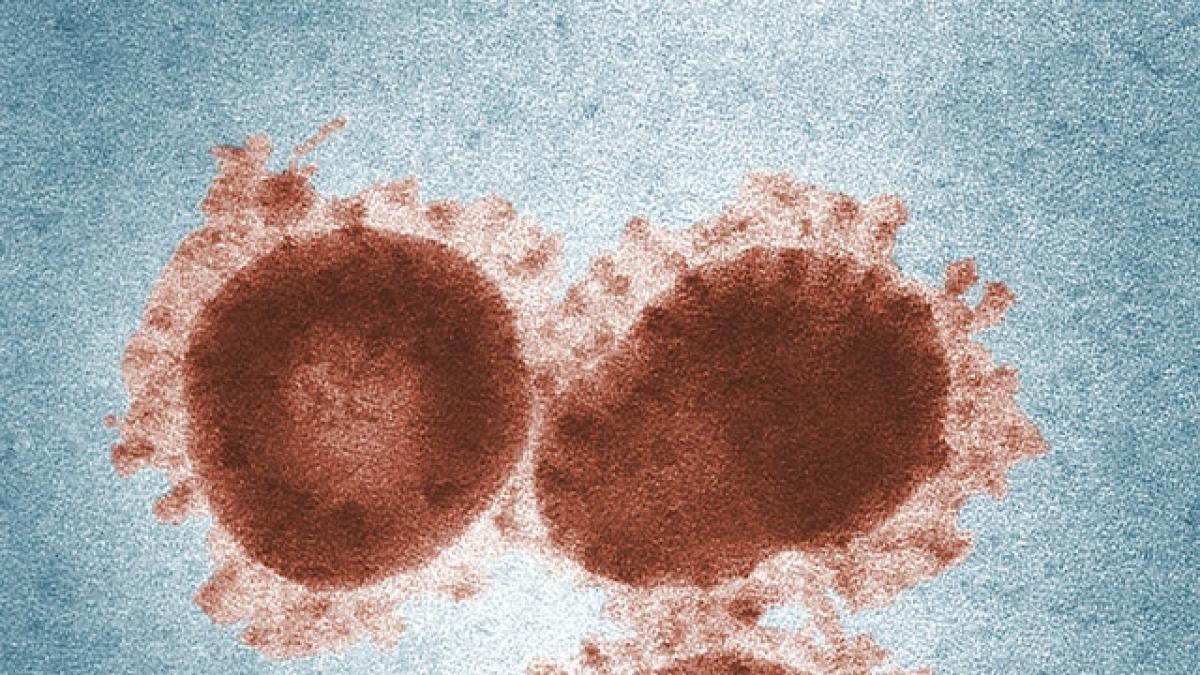 pexels-virus-photo-by-cdc-from-pexels_07277500