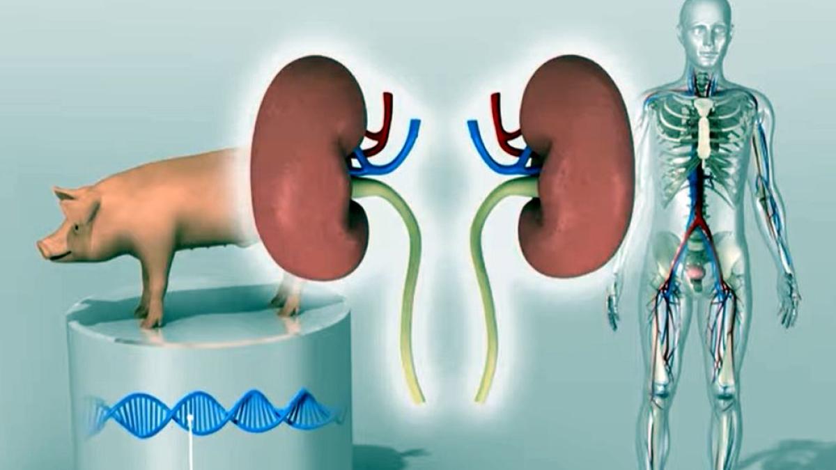 transplant-porc-rinichi-om-university-of-alabama-at-birmingham_65893100