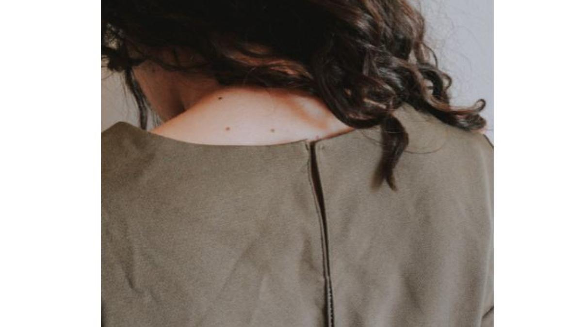 despre_acneea_rozacee_foto_pexels_39156200