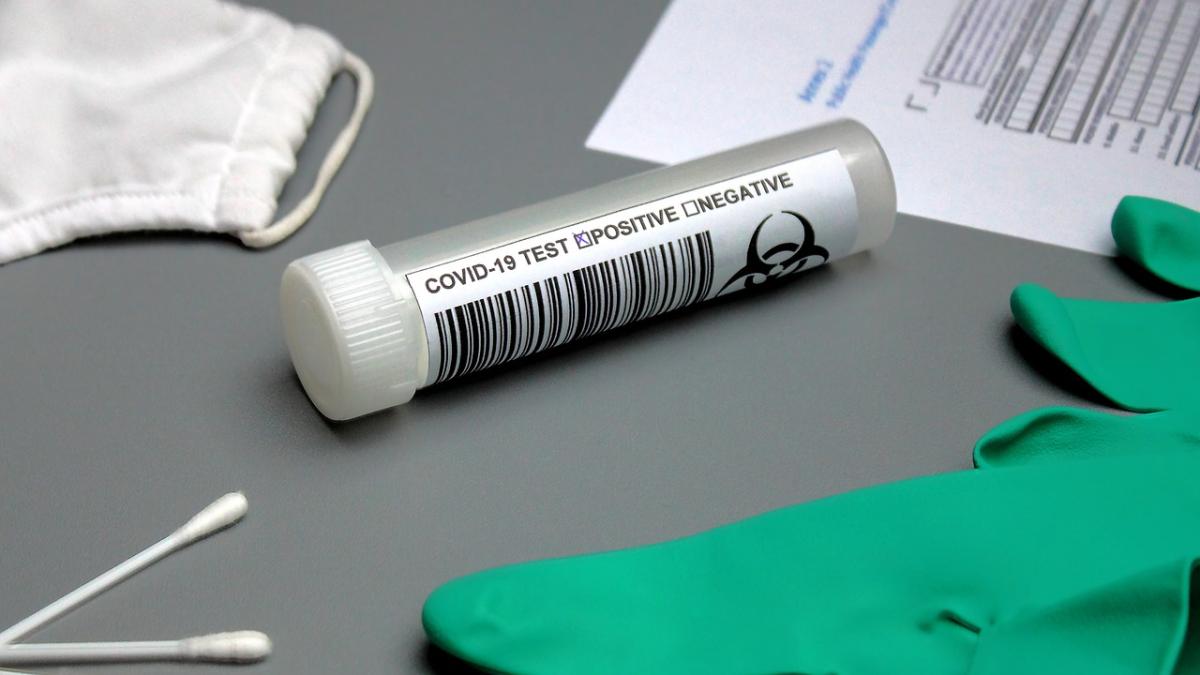 test-antigen-covid_37527900