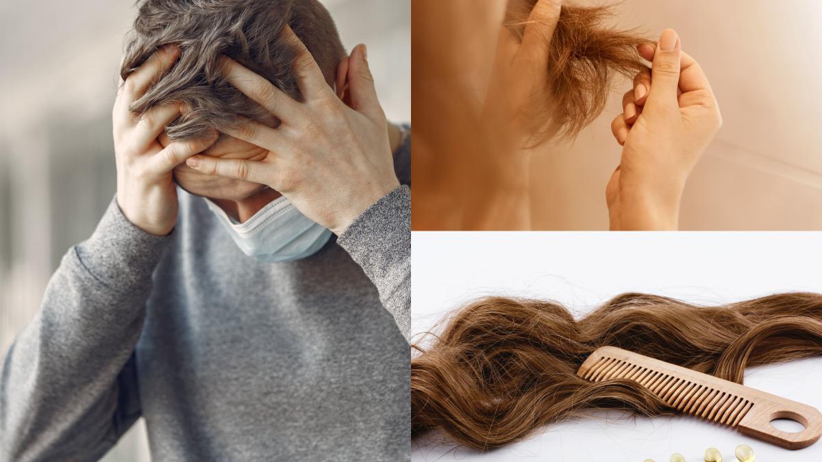 caderea-parului--efect-al-long-covid--studiu-alarmant-despre-nepasarea-romanilor-trecuti-prin-boala--_educati_-pe-internet_-probleme-neurologice-grave_08357800